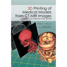 3D Printing of Medical Models from CT-MRI Images: A Practical step-by-step guide - Paperback